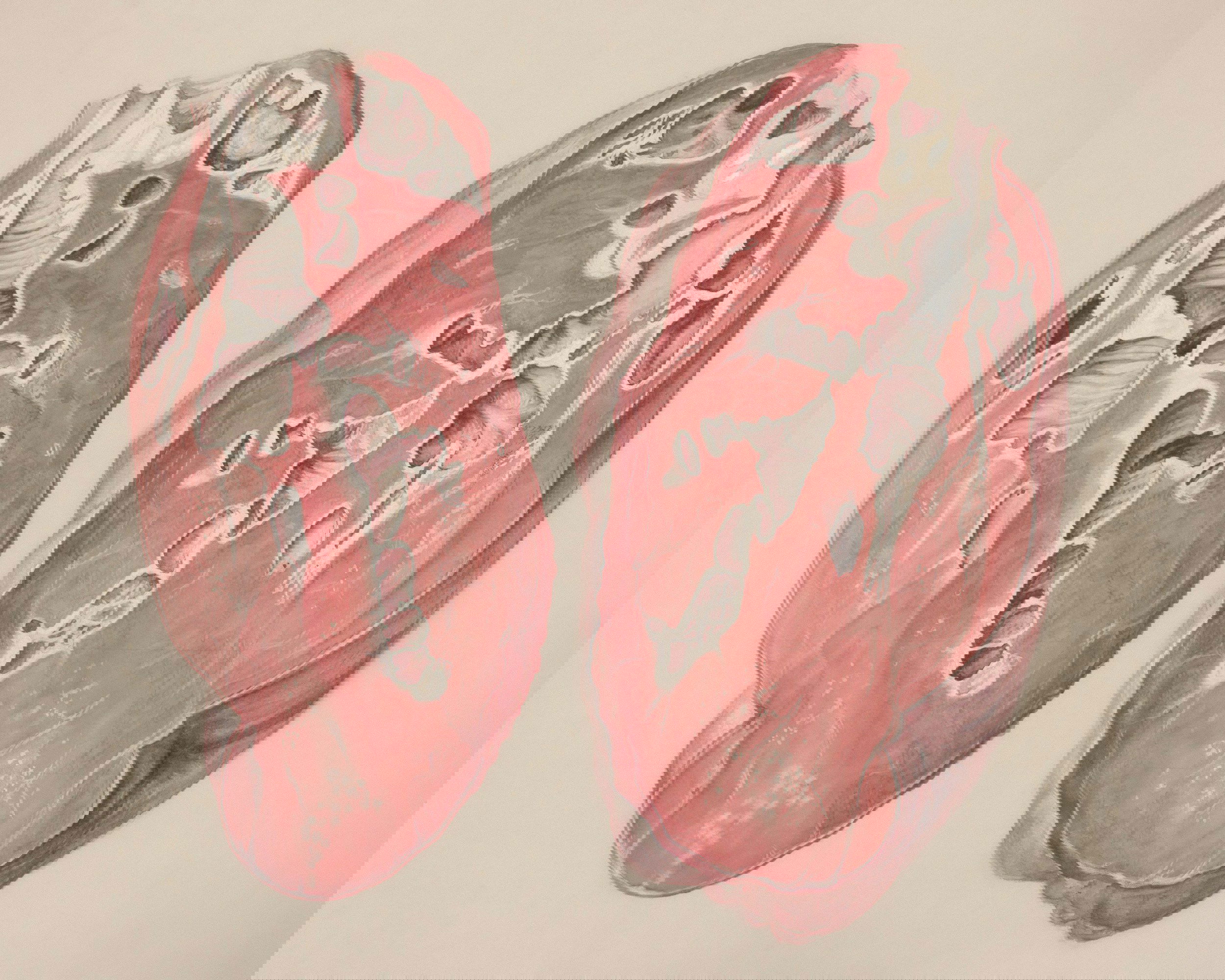 cross section of diseased lungs