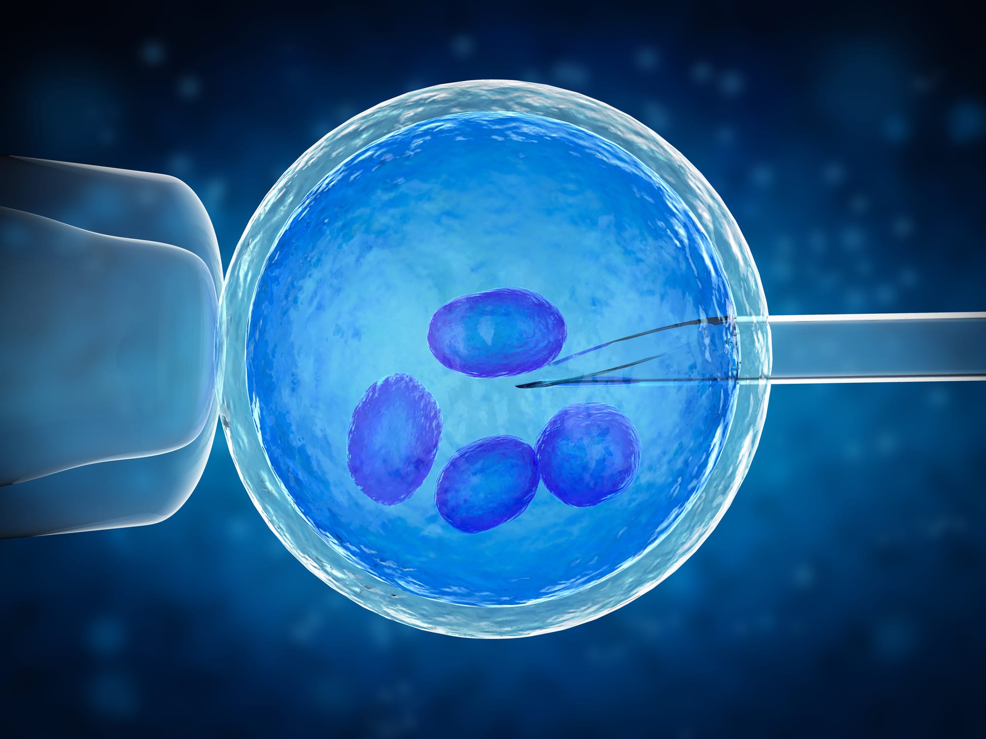 הפריה חוץ-גופית (IVF)