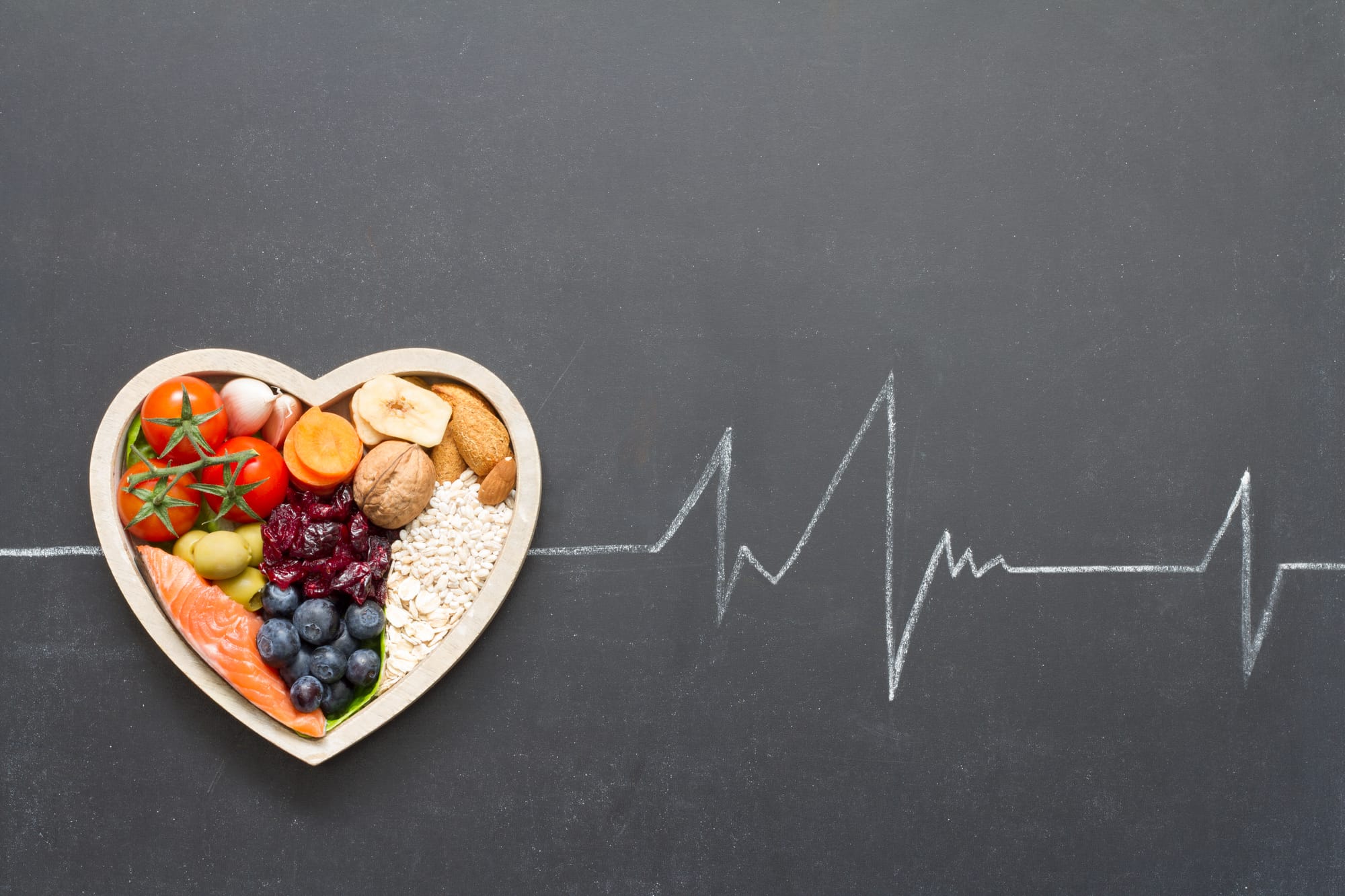 Diet Plan for a Sri Lankan Patient with High Cholesterol