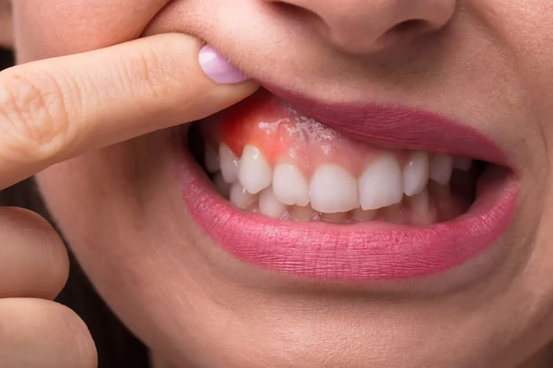 Gum Disease Treatment: Your Guide To Periodontal Care