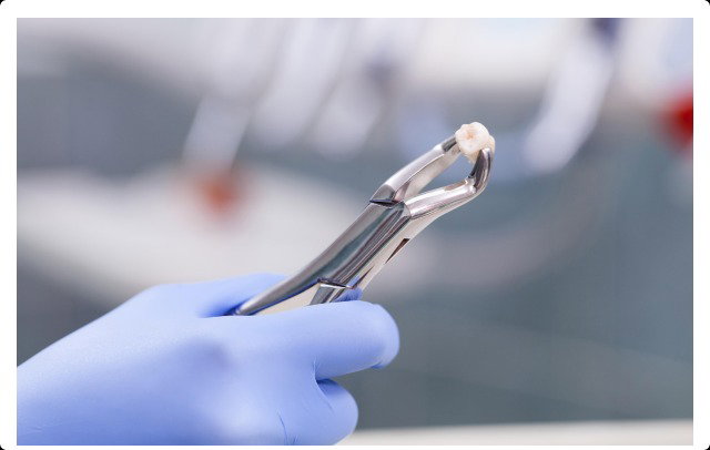 Must-Check Factors Guide: How to Find the Best Dentist