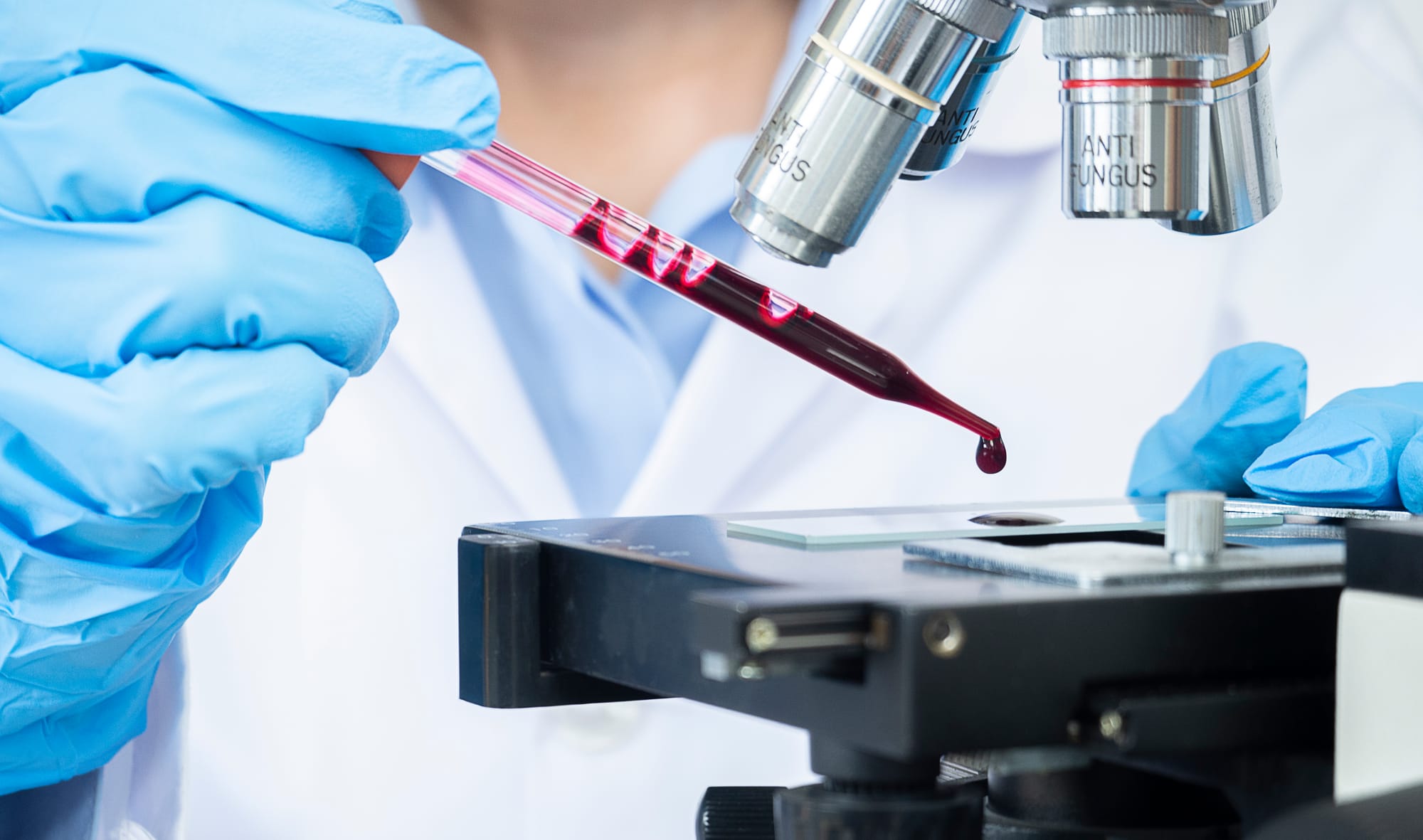 VAŽNOST PREVENTIVNIH PREGLEDA OD NAJ RANIJE DOBI U SVRHU OTKLANJANJA NASTANKA  INVALIDITETA