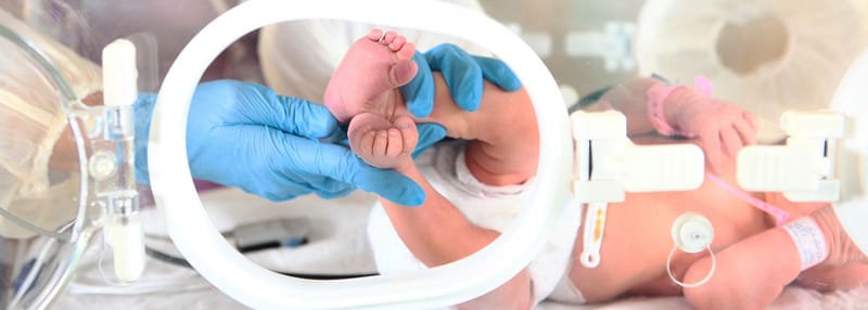 PRIJEVREMENI POROD I RAZVOJNE TEŠKOĆE KOD DJECE