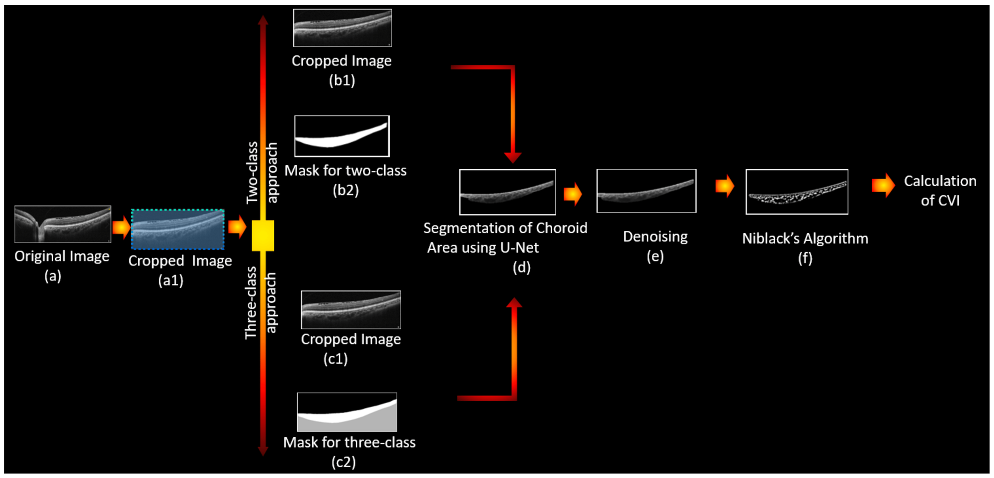 Automatic Choroid Vascularity Index Calculation in Optical Coherence Tomography Images with Low-Contrast Sclerochoroidal Junction Using Deep Learning