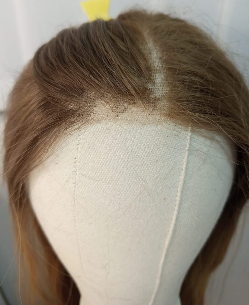 Bald Patches