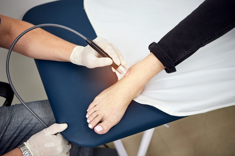 LASER DE ALTA INTENSIDADE