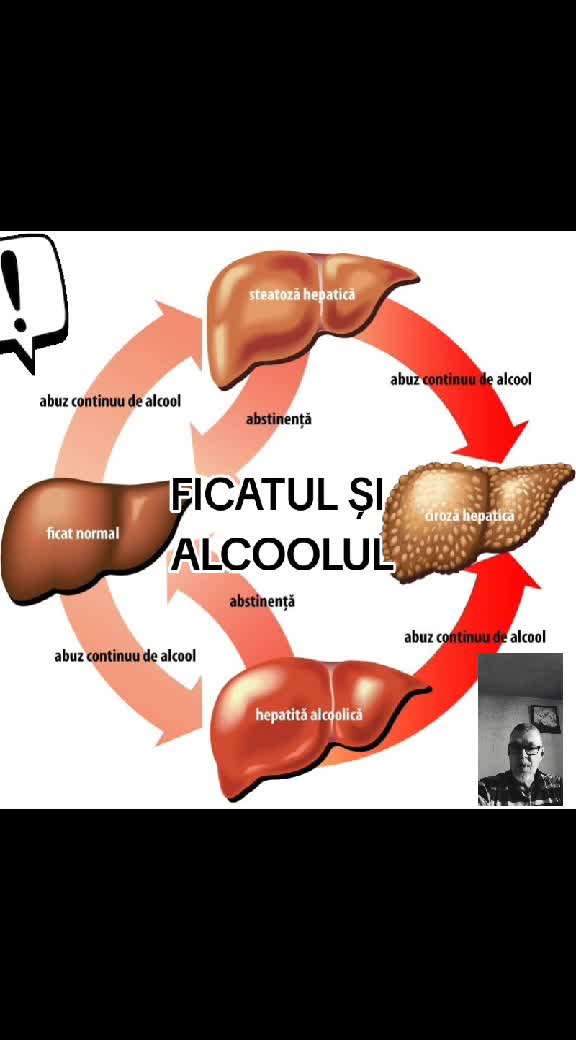 Ficatul și alcoolul