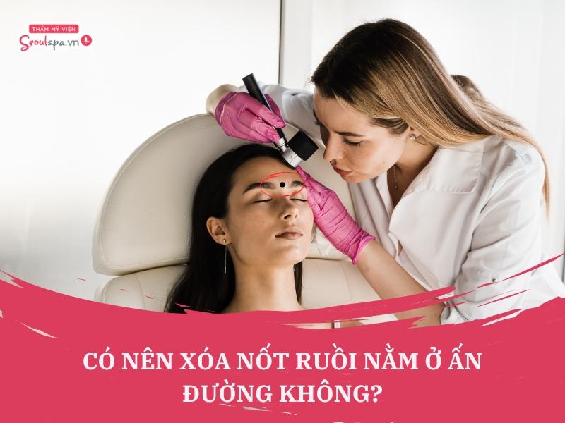 Xóa nốt ruồi ở ấn đường