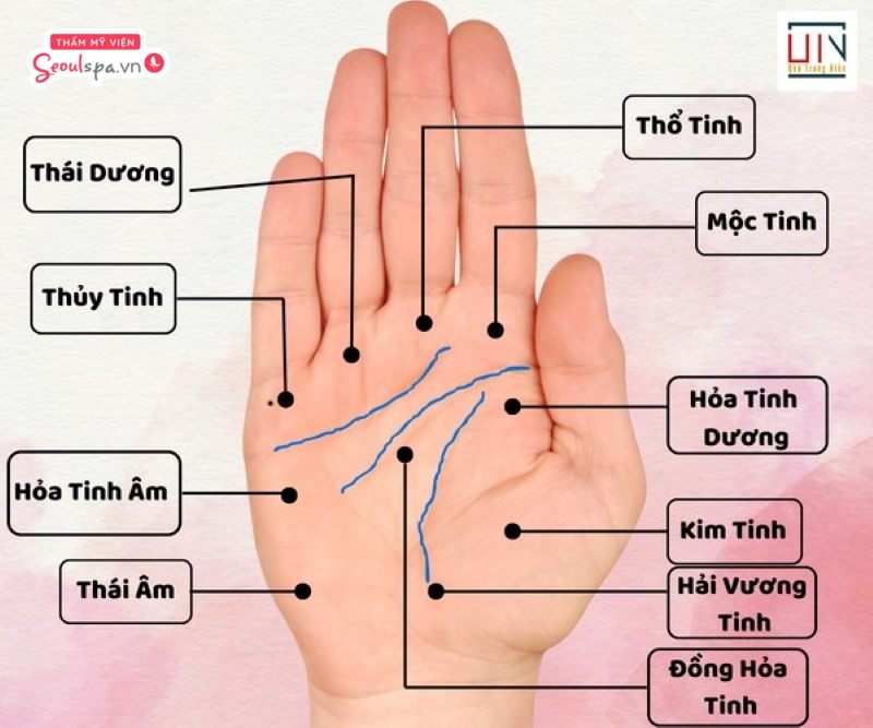 Nốt ruồi trên lòng bàn tay