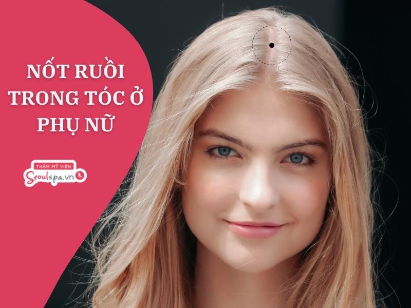 Nốt ruồi trong tóc tốt hay xấu