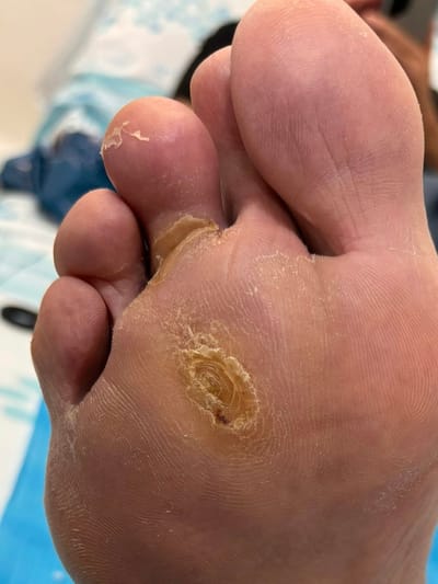 זה רק עור יבש