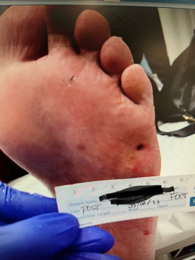 זה רק פצע קטן