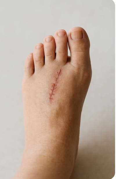 צלקות של ניצחון: מסע הריפוי דרך קשיים וכשלונות