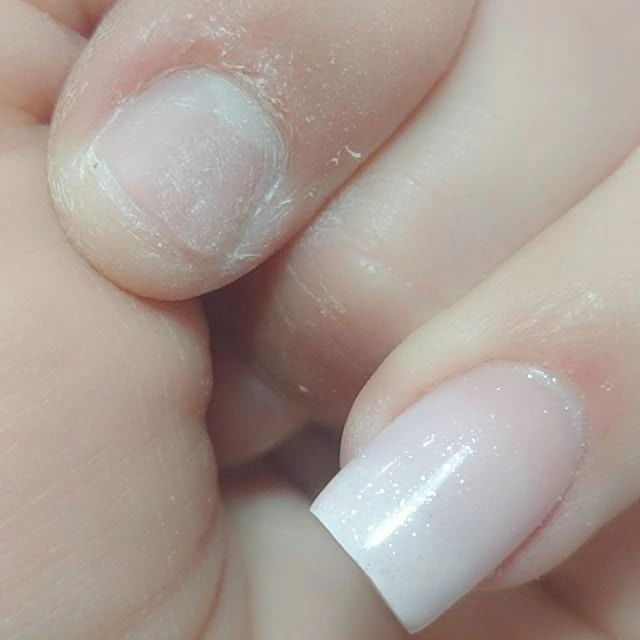 Construction d 'un ongle rongé