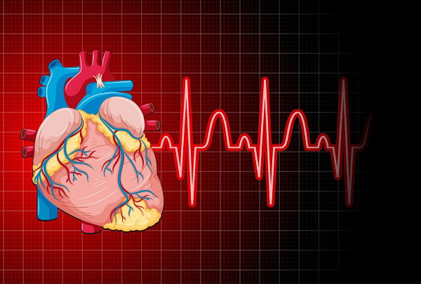 Arrhythmia: Causes, Symptoms, Diagnosis, Treatment