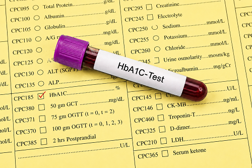 Factors That Can Affect Your HbA1c Result
