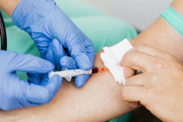 What Is a Lipid Profile Test and Why Is It Important?