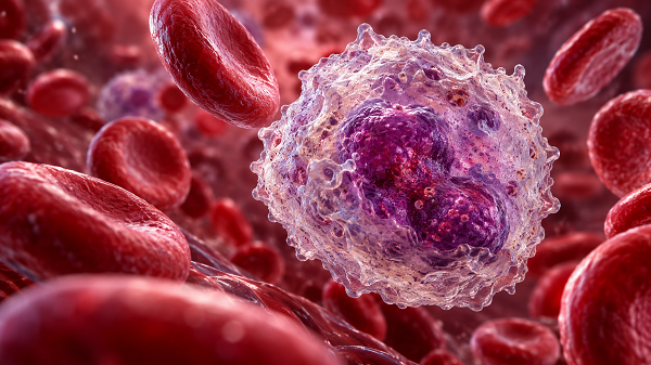 Leukaemia: What Causes It and How Is It Treated?