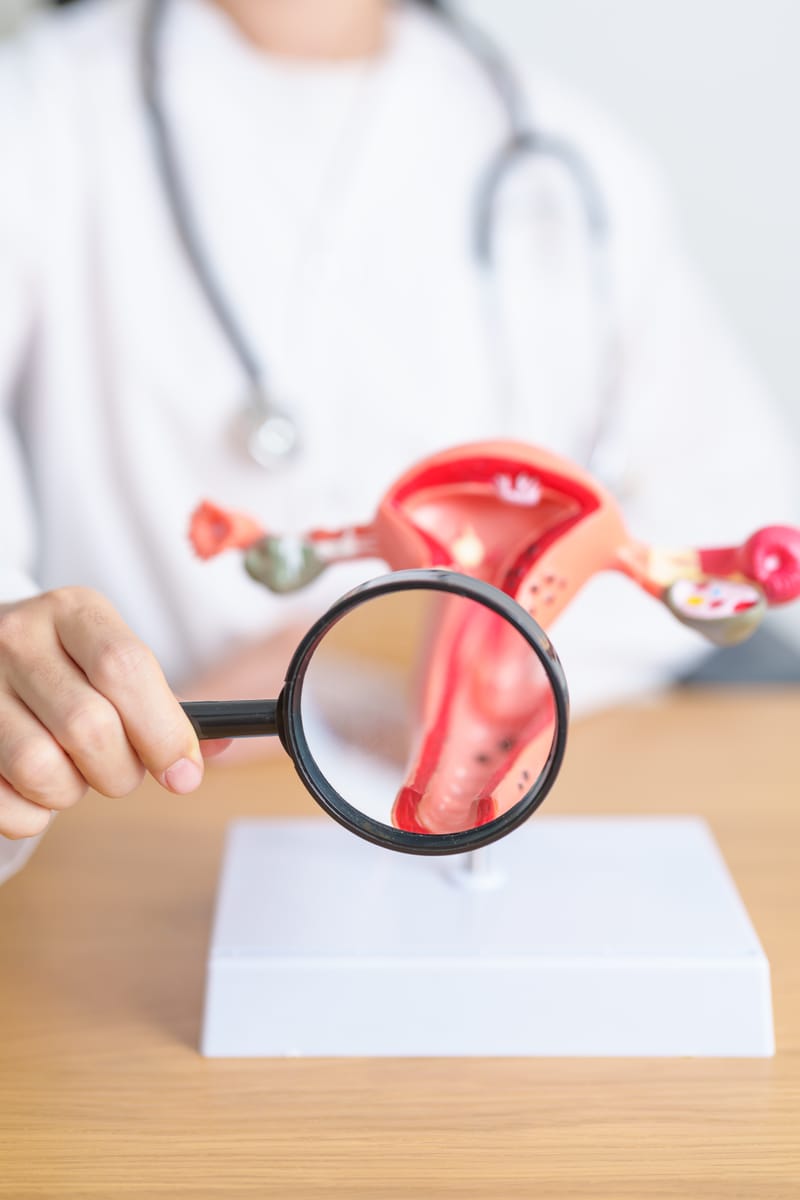 ربط عنق الرحم عن طريق المهبل