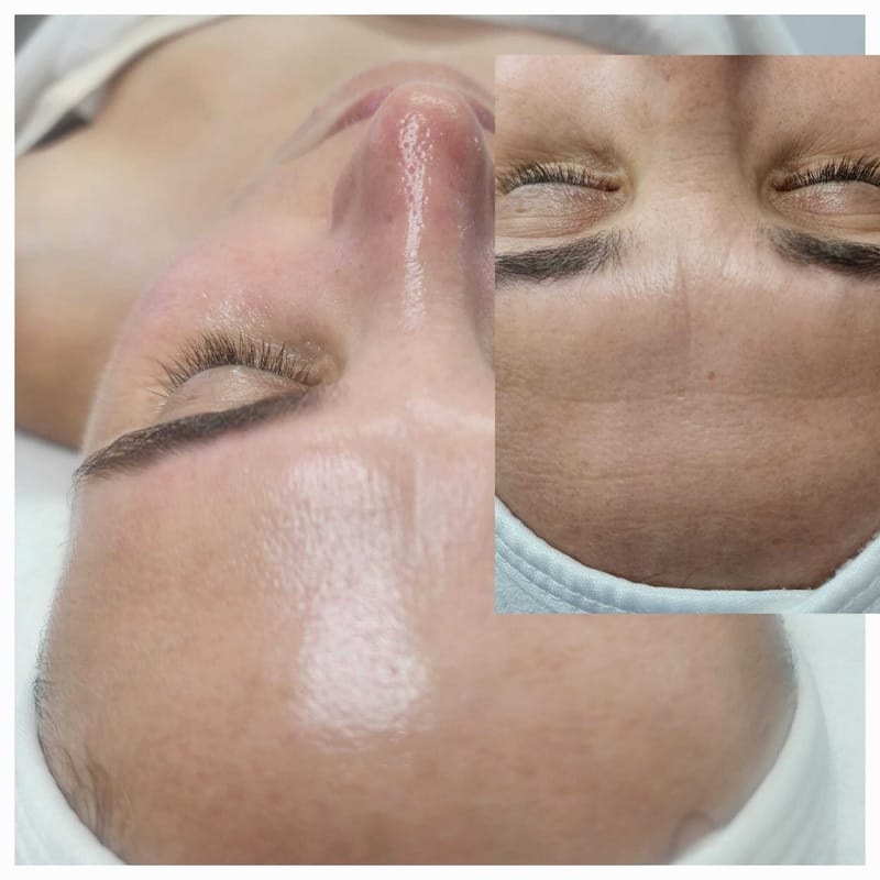 טיפול קוויאר Juliettte Armand