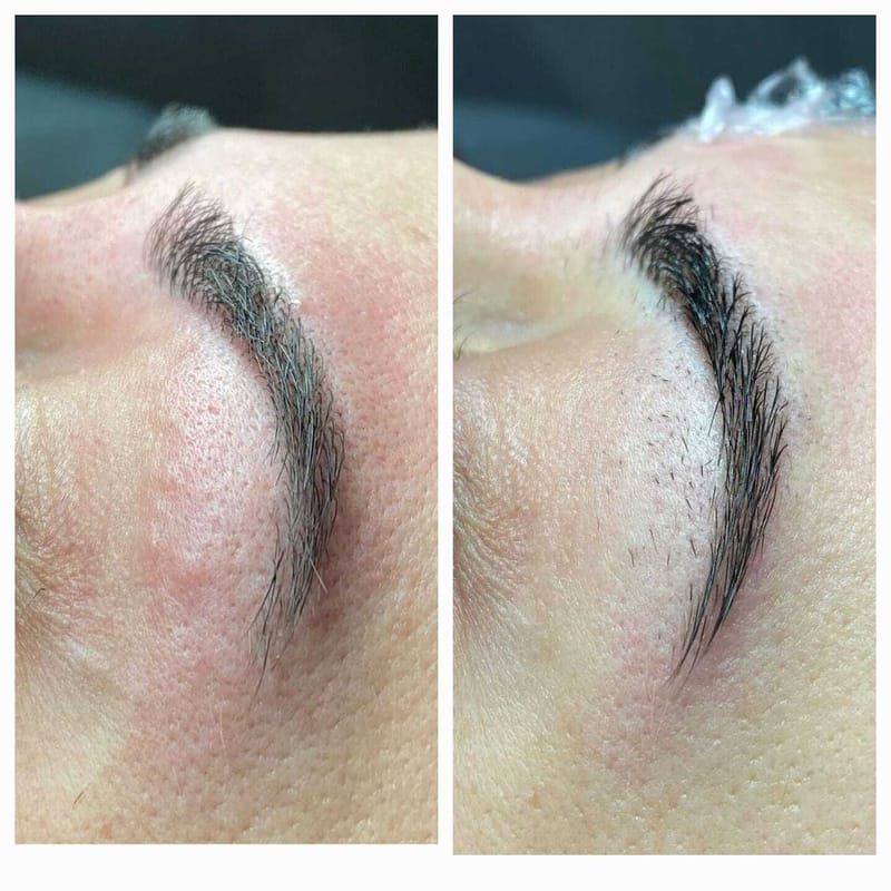 אפילציה גבות