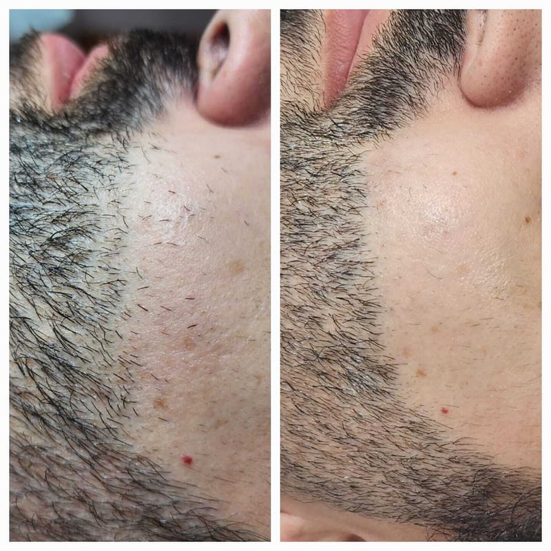 קו זקן לגבר