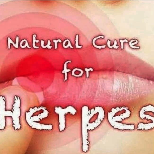 Herpes natural remedies
