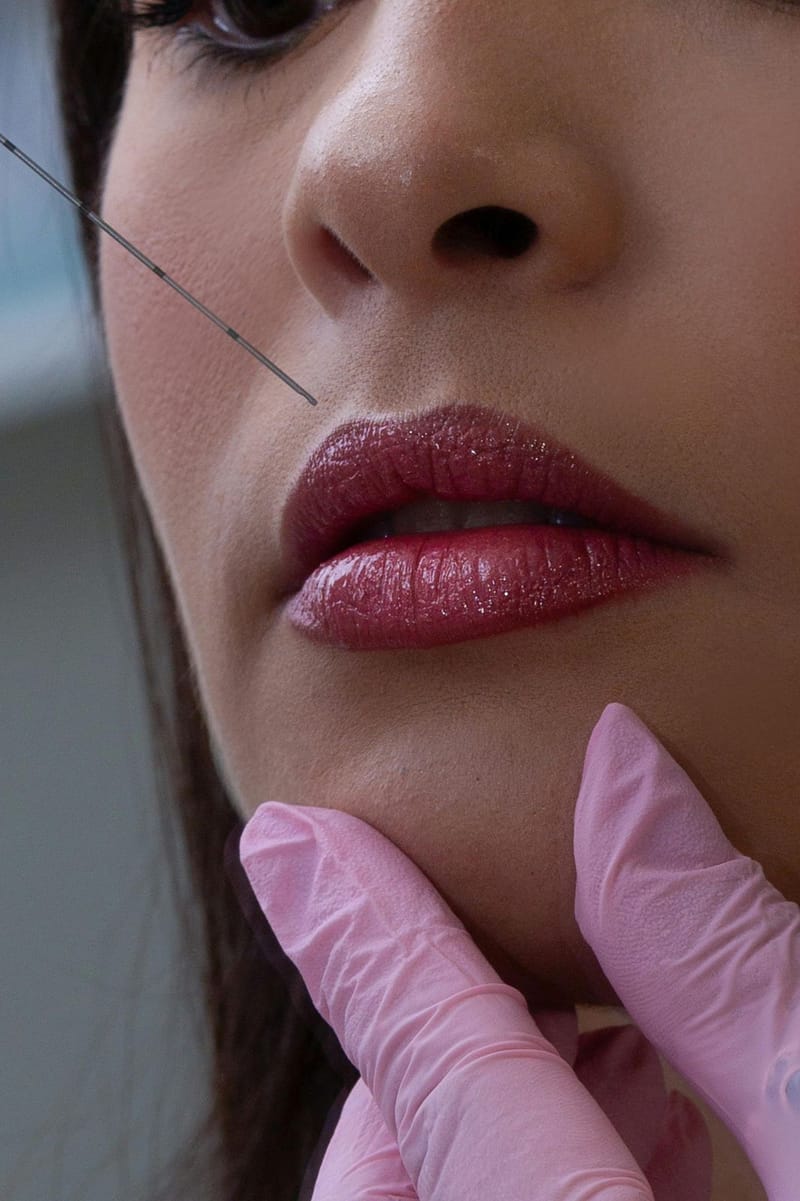 Preenchimento Facial