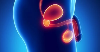 Chirurgie reconstructive urologique à Istanbul