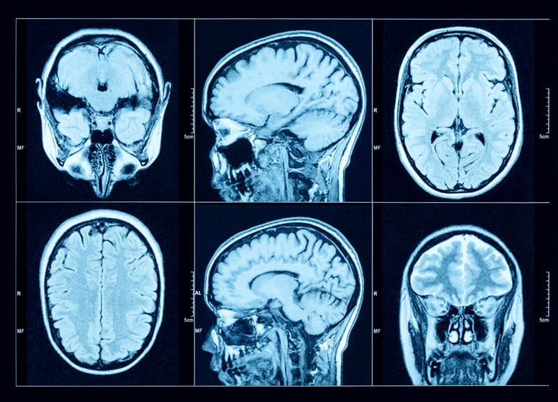Clinical Case Study: Executive Recovery