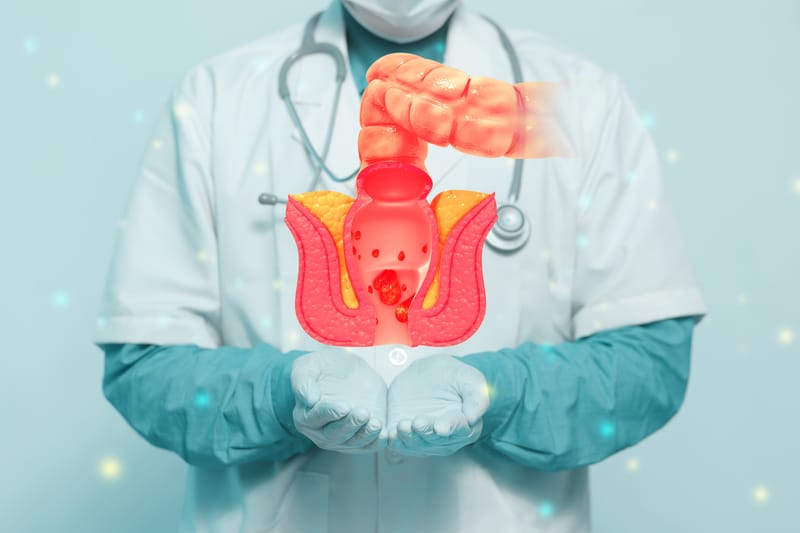 Cirurgia para Plicomas Anais