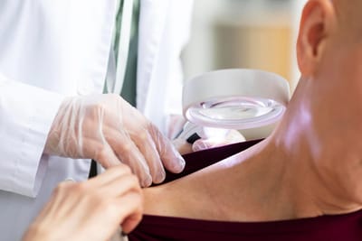 How Much Do Skin Wart Removal Procedures Cost?