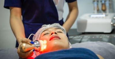 How Pico Laser Works to Erase Wrinkles and Fine Lines