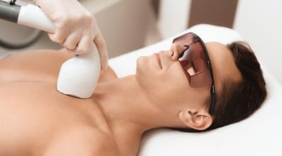 How Much Does Laser Hair Removal Cost for Men’s Back and Chest?