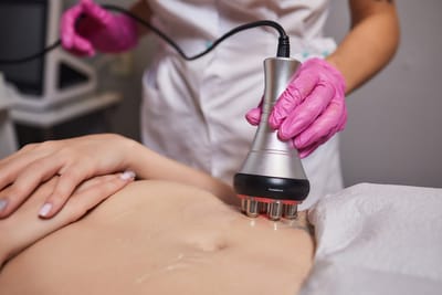 CoolSculpting and Weight Loss: Are They Linked?