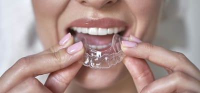 How to Choose Invisalign and Stay Within Your Budget