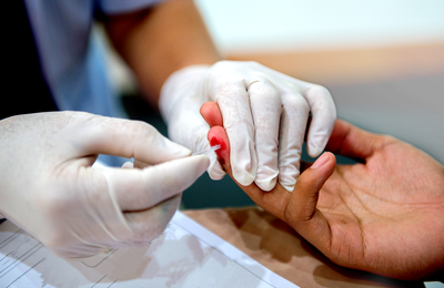 How Mycoplasma Tests in Dubai Help Detect Hidden Infections