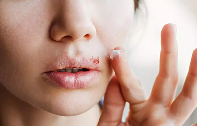 Protect Your Health: Why You Should Choose an STD Test in Dubai