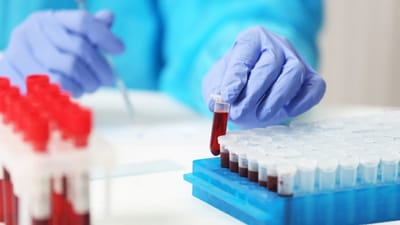 Men’s Health Made Simple: Blood Test at Home in Dubai