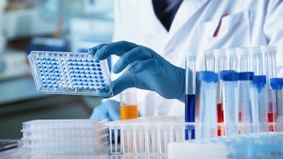 Liver & Kidney Function blood Test at Home in Dubai
