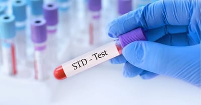 STD Test in Dubai Quality Control: Ensuring Accurate Results