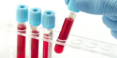 Safe & Sterile Blood Test at Home in Dubai