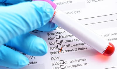 Vitamin D: Through Blood Test at Home Why It’s Important