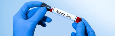 How Anemia Shows Up in Full Body Checkup at Home