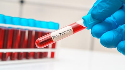 Heavy Metal Poisoning from Blood Test at Home