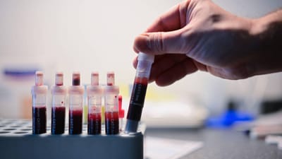 Blood Test at Home and Its Role in Stress Management