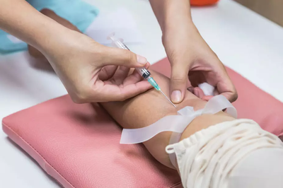 Is IV Drip Good for Liver Support?