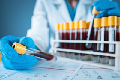 Can a Blood Test at Home Detect Diseases?