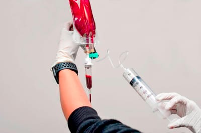 IV Drip for Fibromyalgia Relief