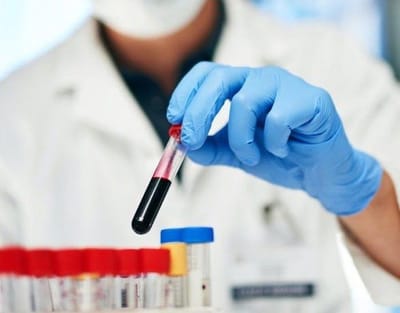 The Link Between Mood and Blood Test at Home Results